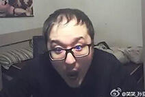 lol笑笑:花6万植头发 然而头发却越来越少